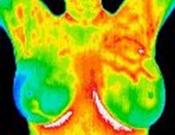 Thermography in Medicine Colour Map 1