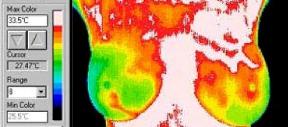 Thermography in Medicine Colour Map 5
