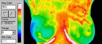 Thermography in Medicine Colour Map 4