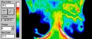 Thermography in Medicine Colour Map 7